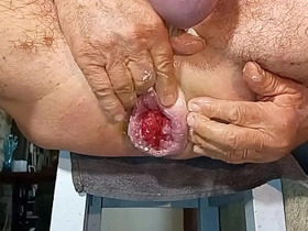 扩肛侠2025-14 chinese teen porn gay