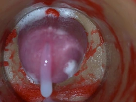 内射实录——体内镜头捕捉男性深喉射精 gay porn chinese hot