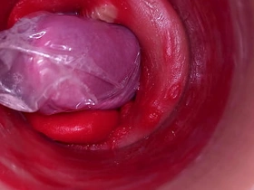 深入阴道的摄像头记录下带着套套的巨量射精 chinese family gay porn